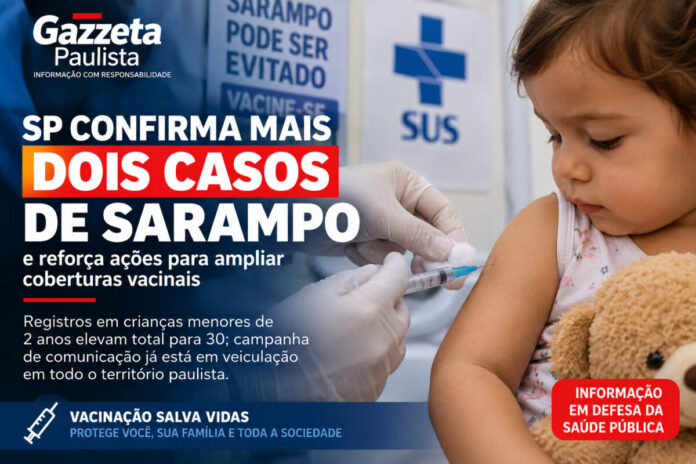 SP confirma casos de sarampo e reforça vacinação SP confirma casos de sarampo e reforça vacinação